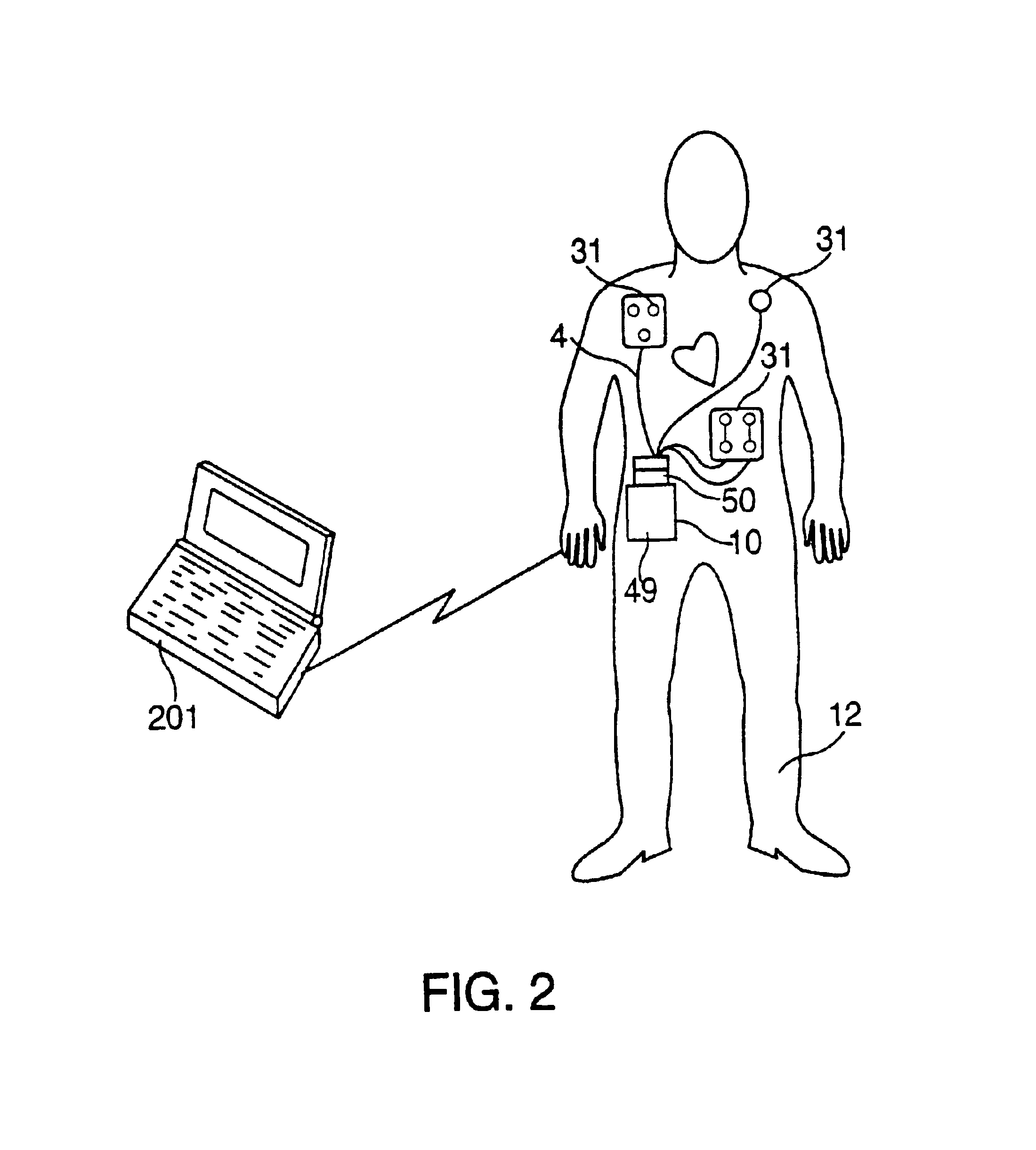 Method of utilizing an external defibrillator by replacing its electrodes