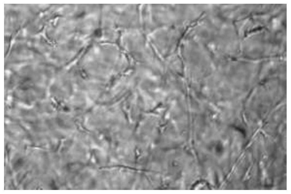 Method for three-dimensionally culturing bone marrow mesenchymal stem cells based on Collagel scaffold method