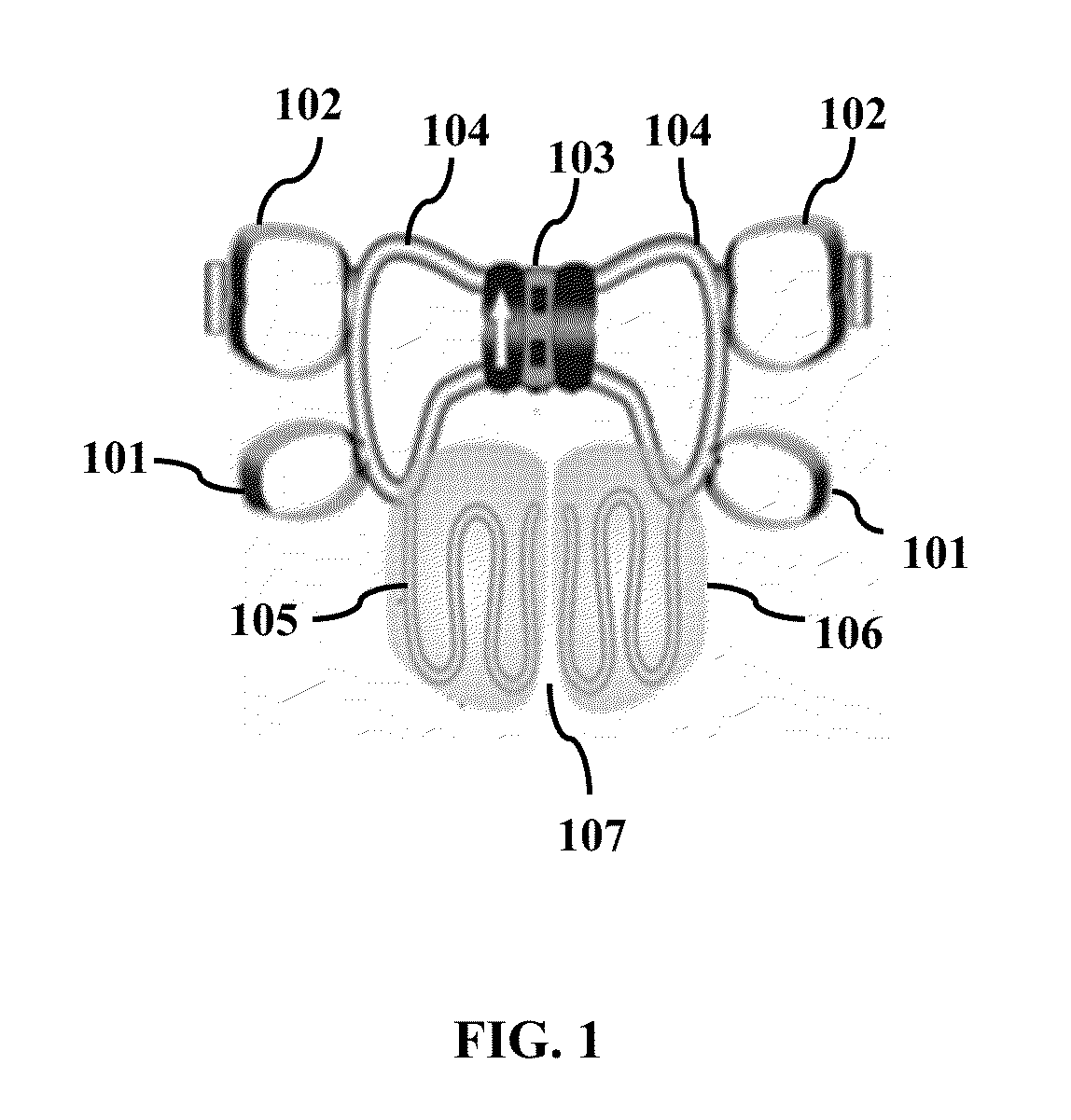 System and method for maxillary protraction in class iii malocclusion patients