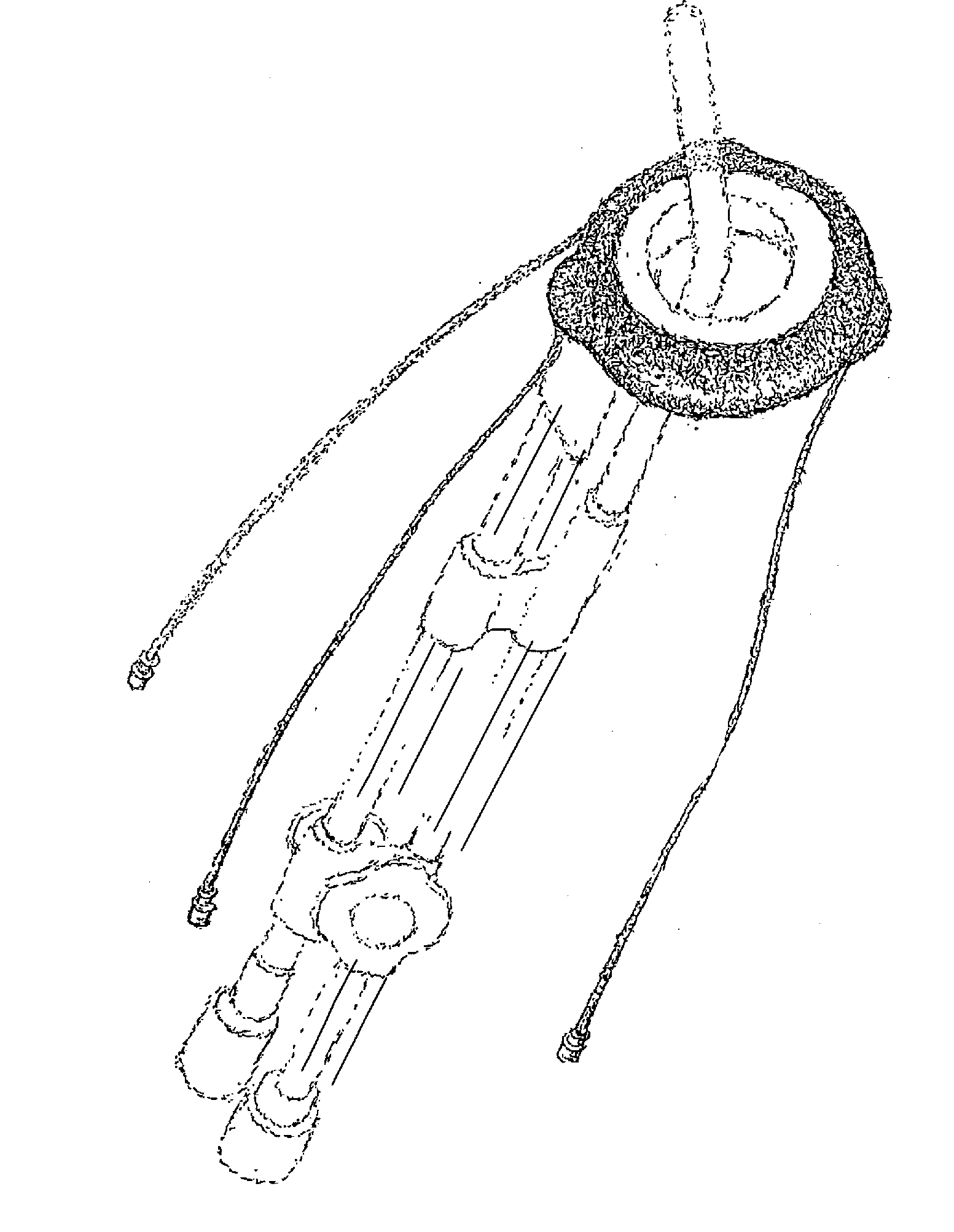 Device and Method for Tissue Displacement in Brachytherapy