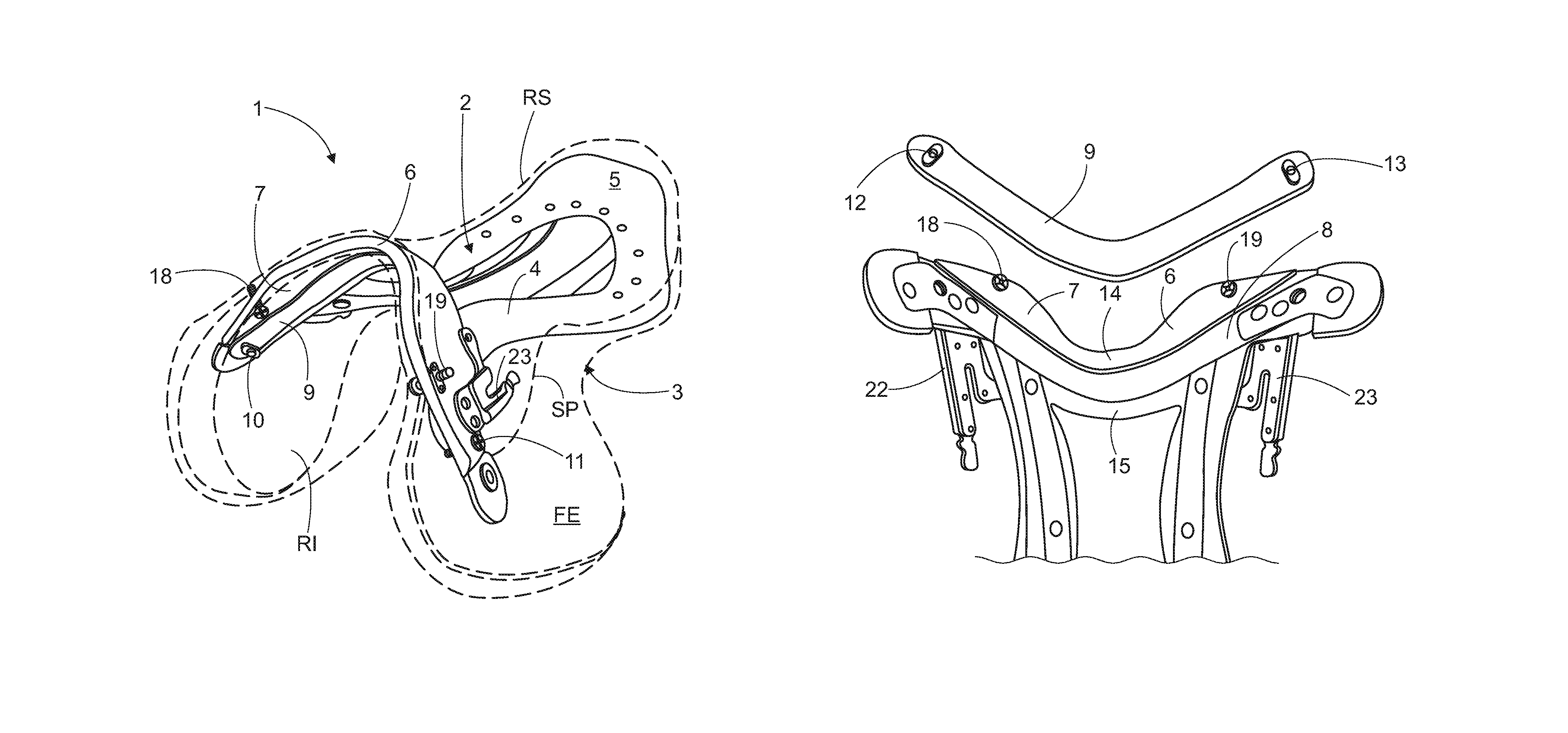 Adjustable saddle and adjusting assembly