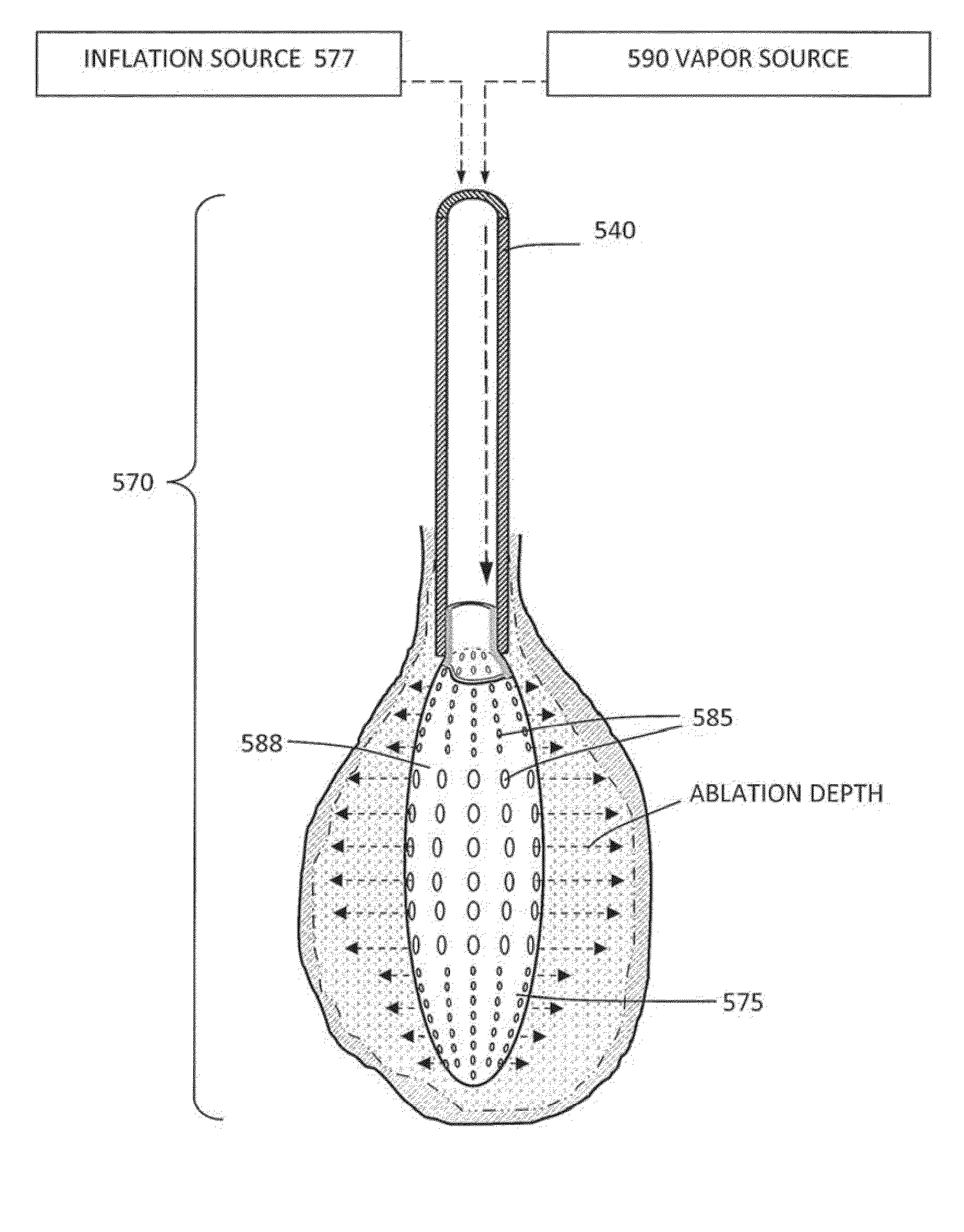 Methods for delivering energy into a target tissue of a body