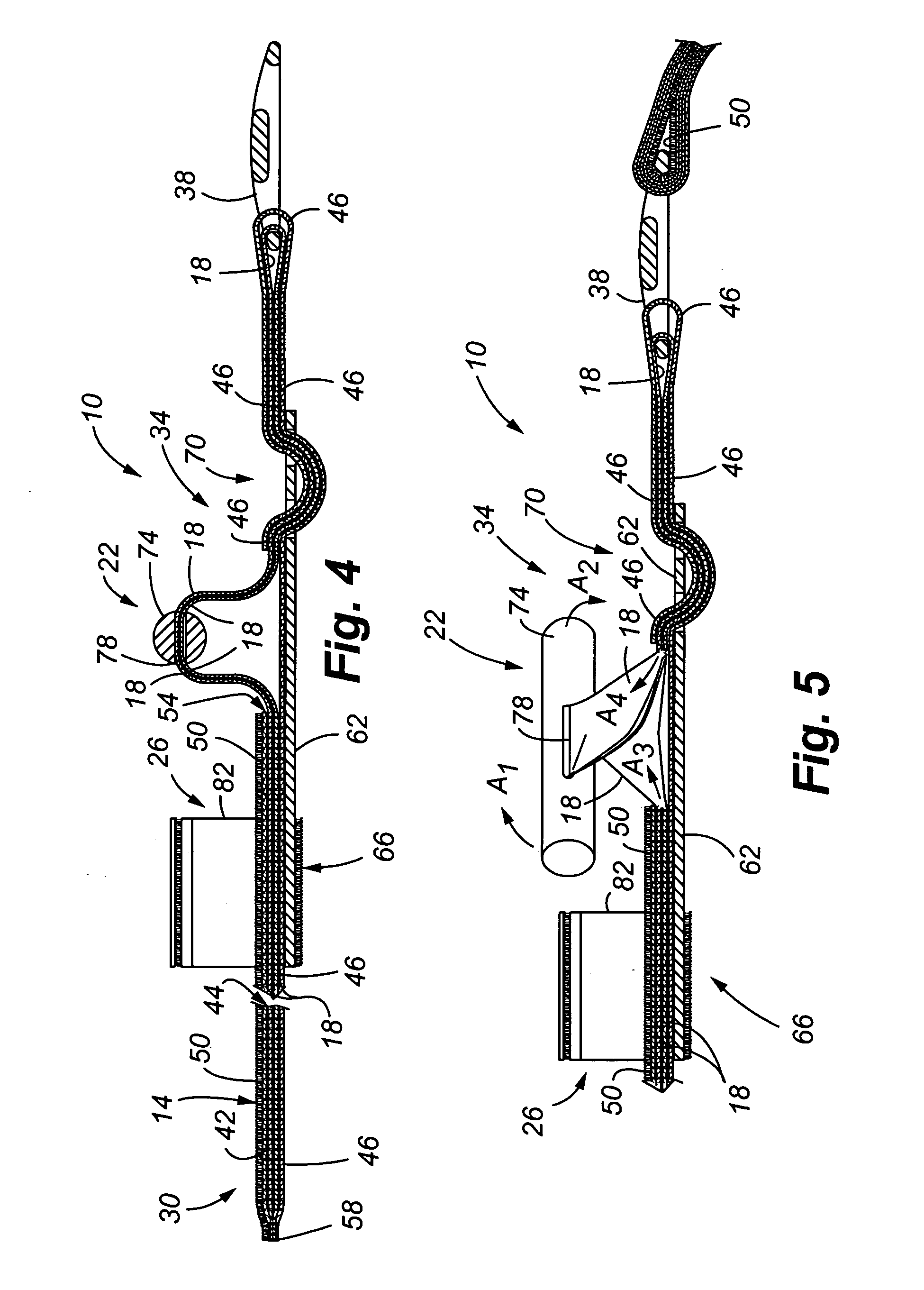 Tourniquet and method of use