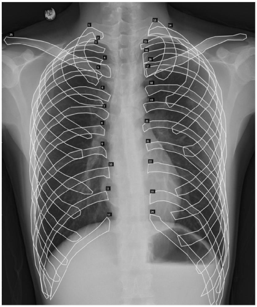 Medical image labeling method and system