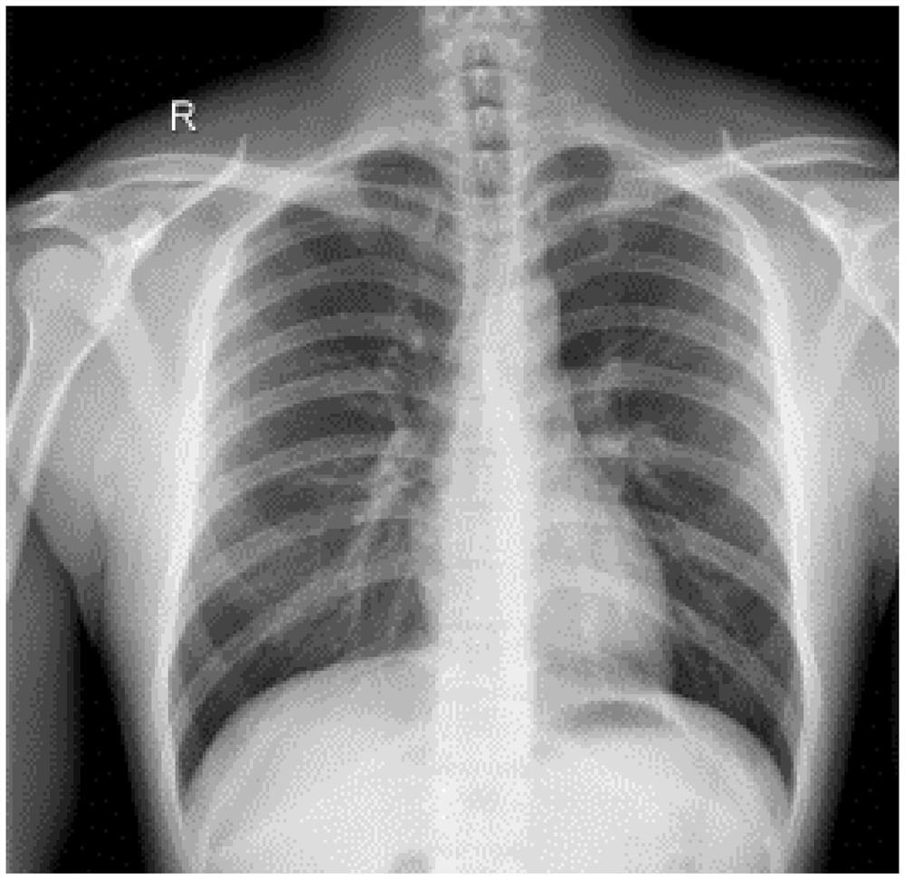 Medical image labeling method and system