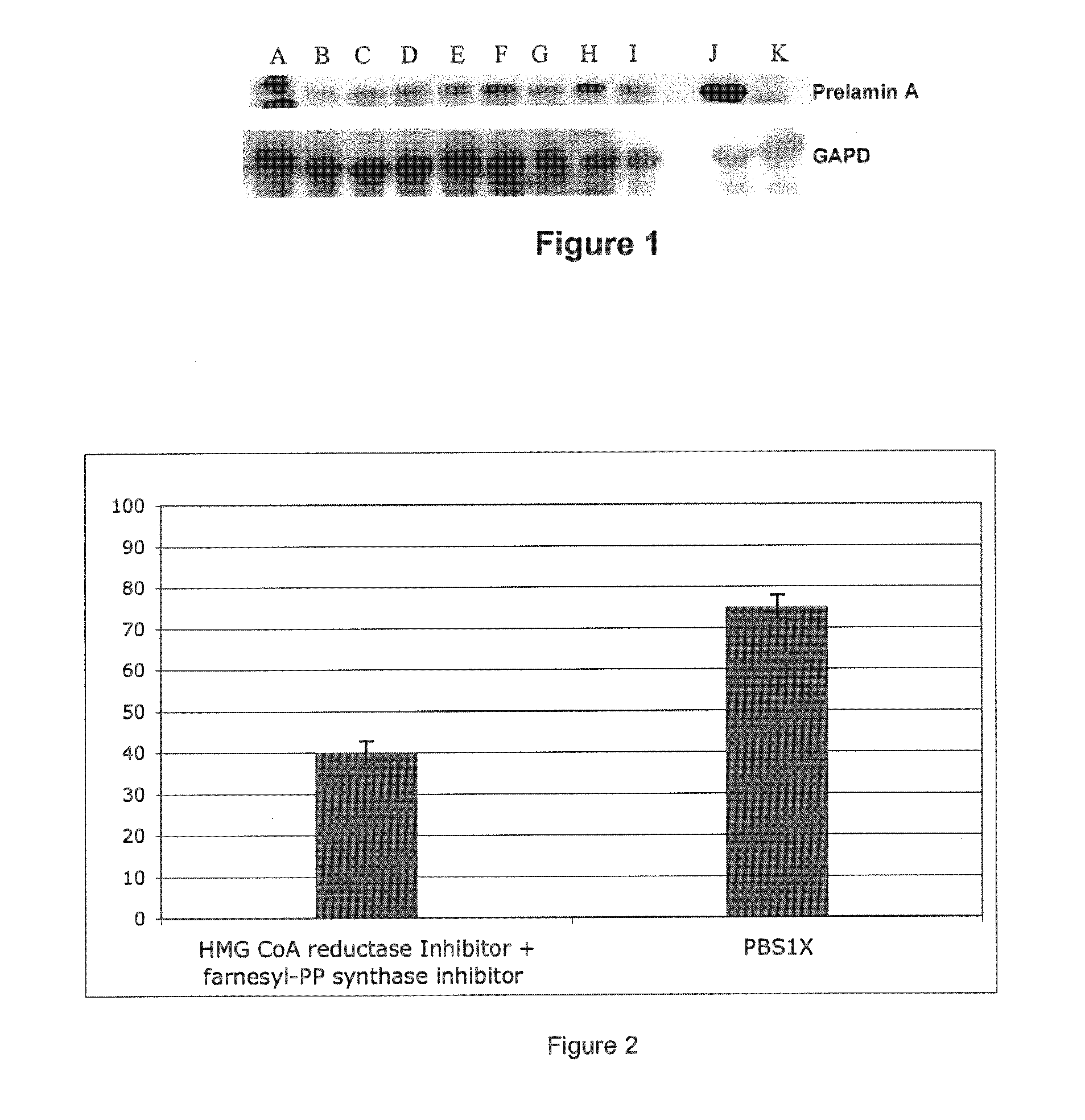 Composition and methods used during Anti-hiv treatment