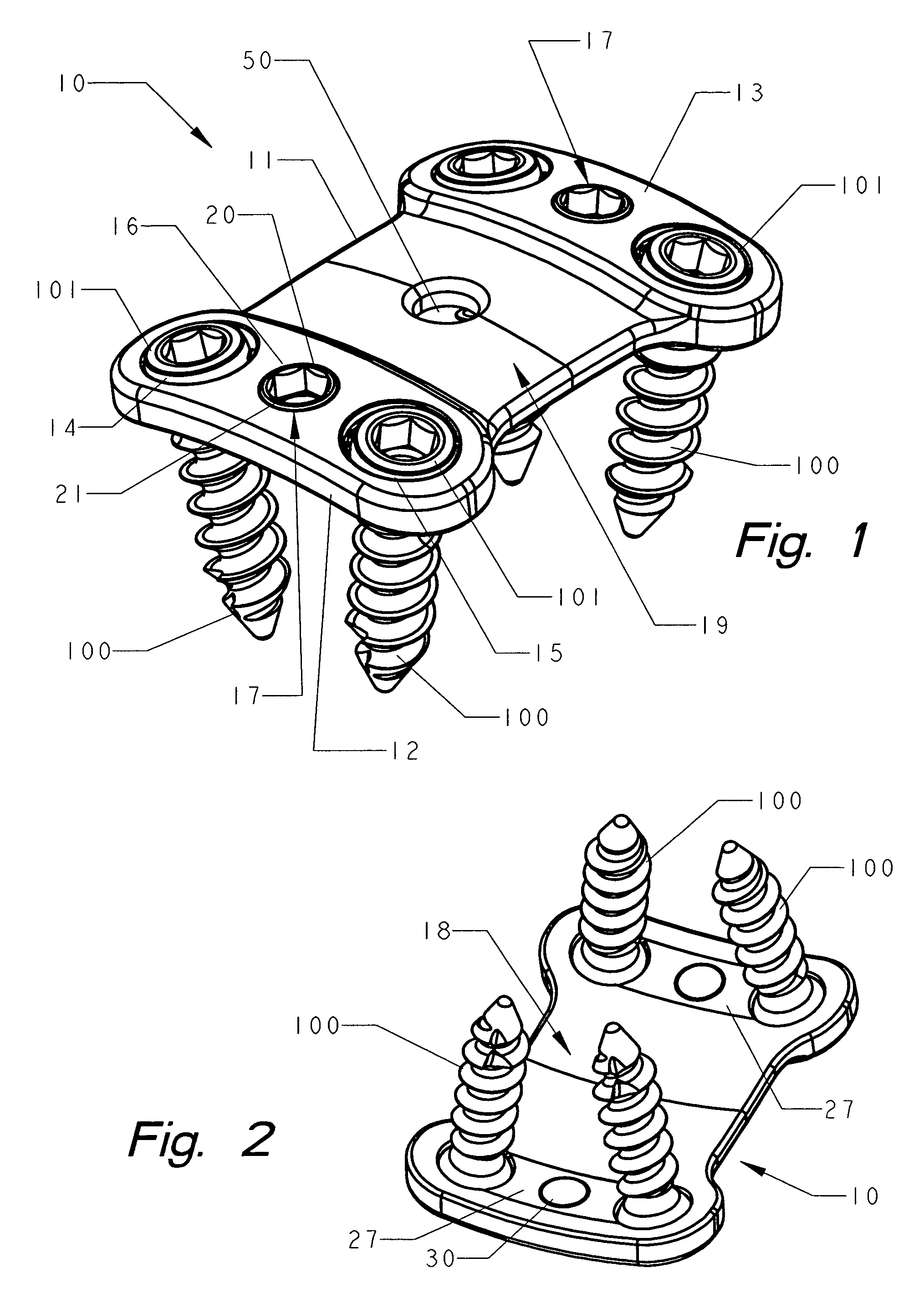 Spinal plate with internal screw locks