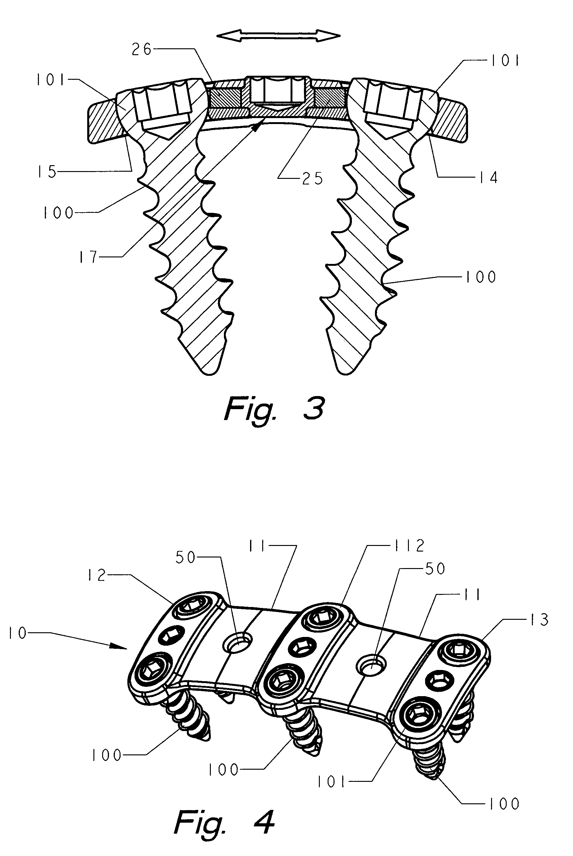 Spinal plate with internal screw locks