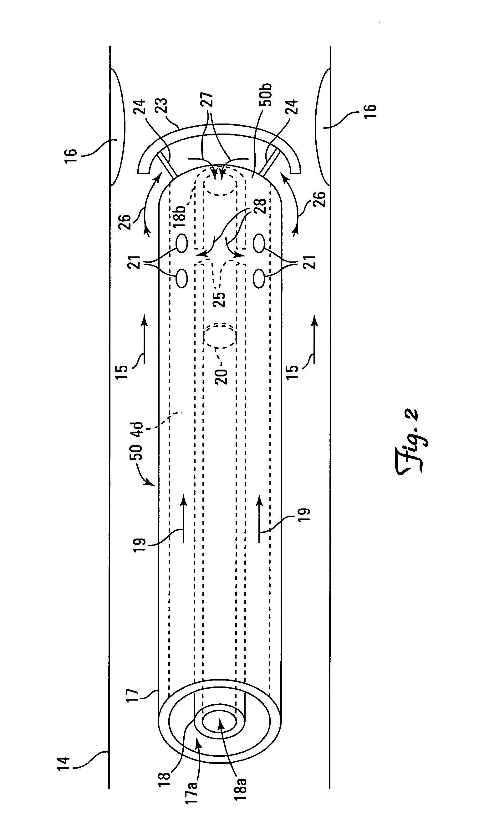 Catheter systems for delivery of agents and related method thereof