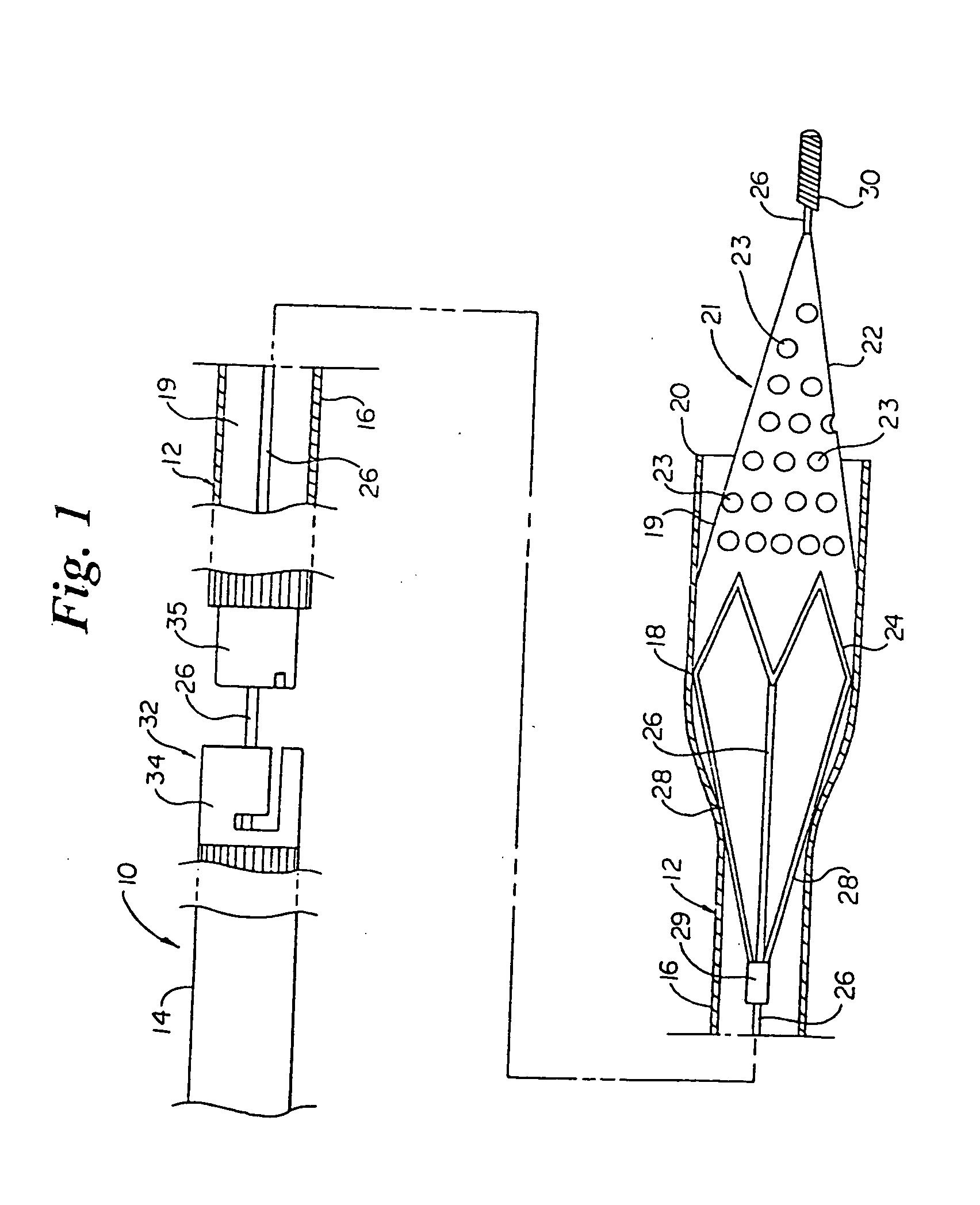 Intravascular filter and method