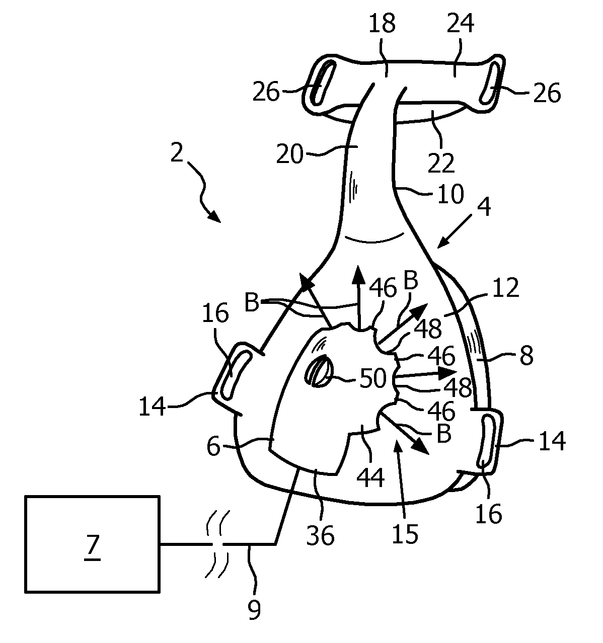 Exhaust gas assembly for a patient interface device