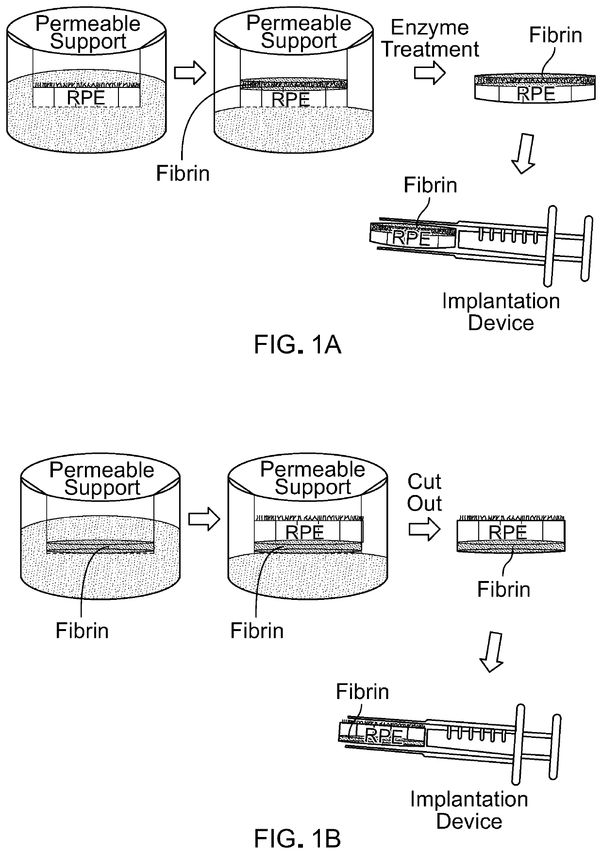 Methods and materials for using fibrin supports for retinal pigment epithelium transplantation