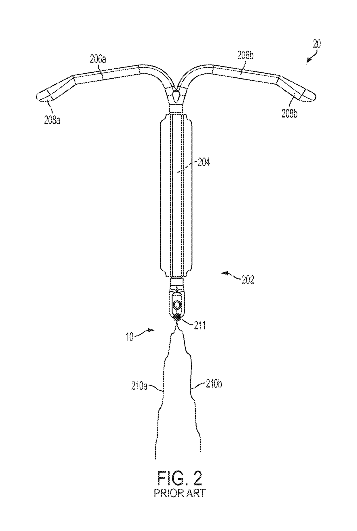 Intrauterine systems, IUD insertion devices, and related methods and kits therefor