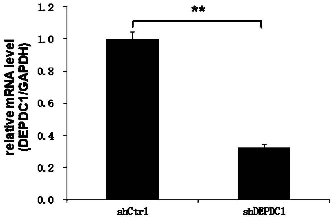 Application of human DEPDC1 gene, and related product