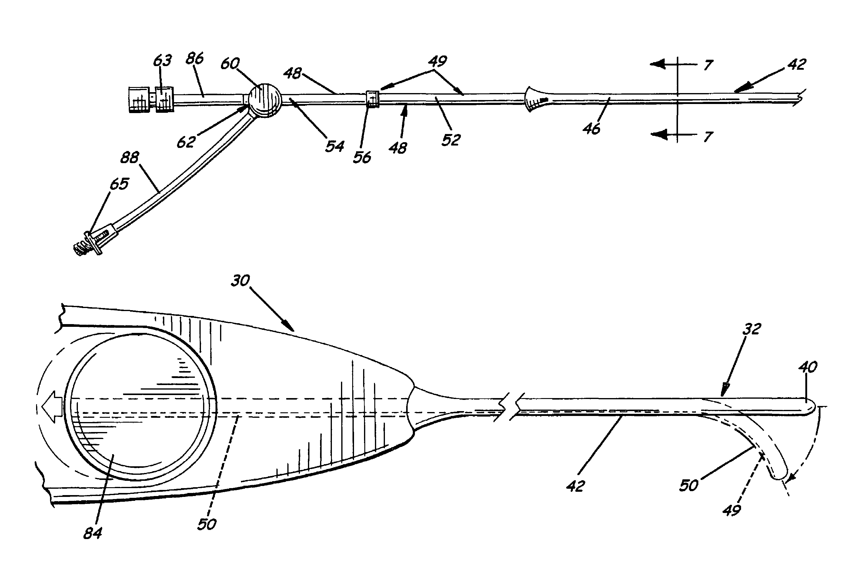 Steerable dilatation system, dilator, and related methods for stepped dilatation