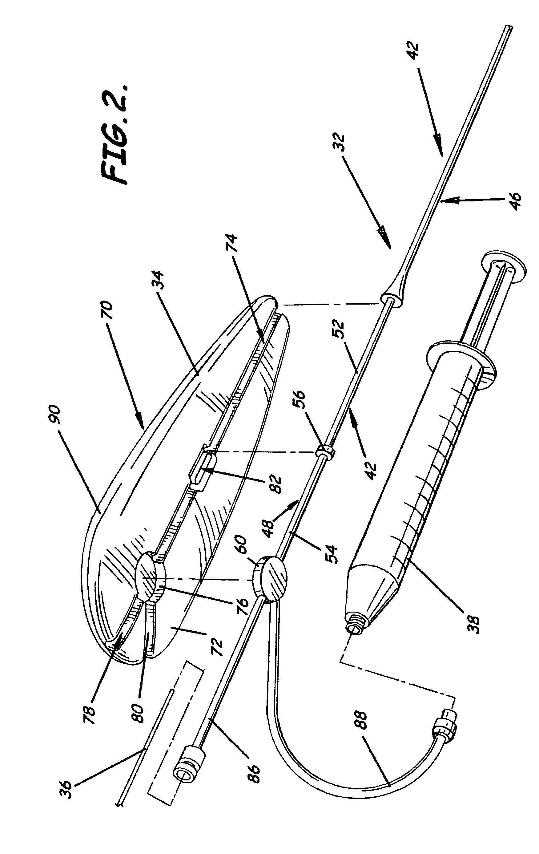 Steerable dilatation system, dilator, and related methods for stepped dilatation