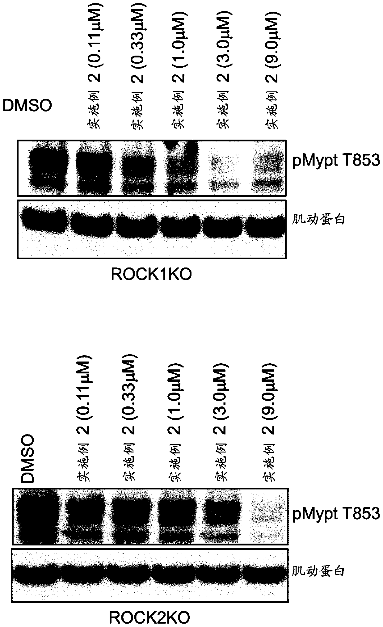 Inhibitors of rho associated coiled-coil containing protein kinase