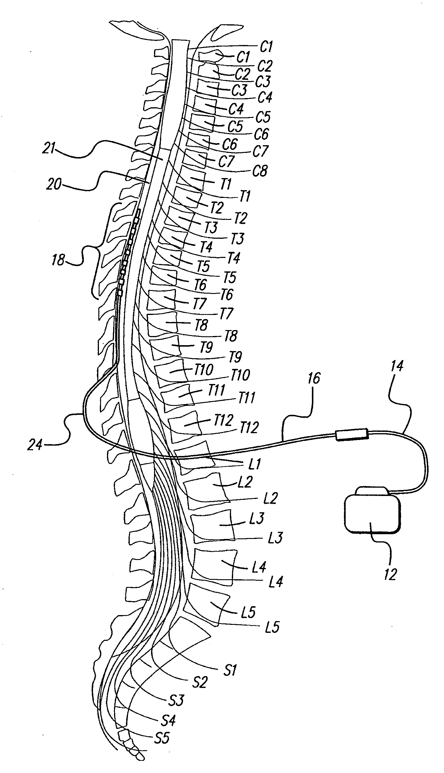 Method for optimizing search for spinal cord stimulation parameter settings