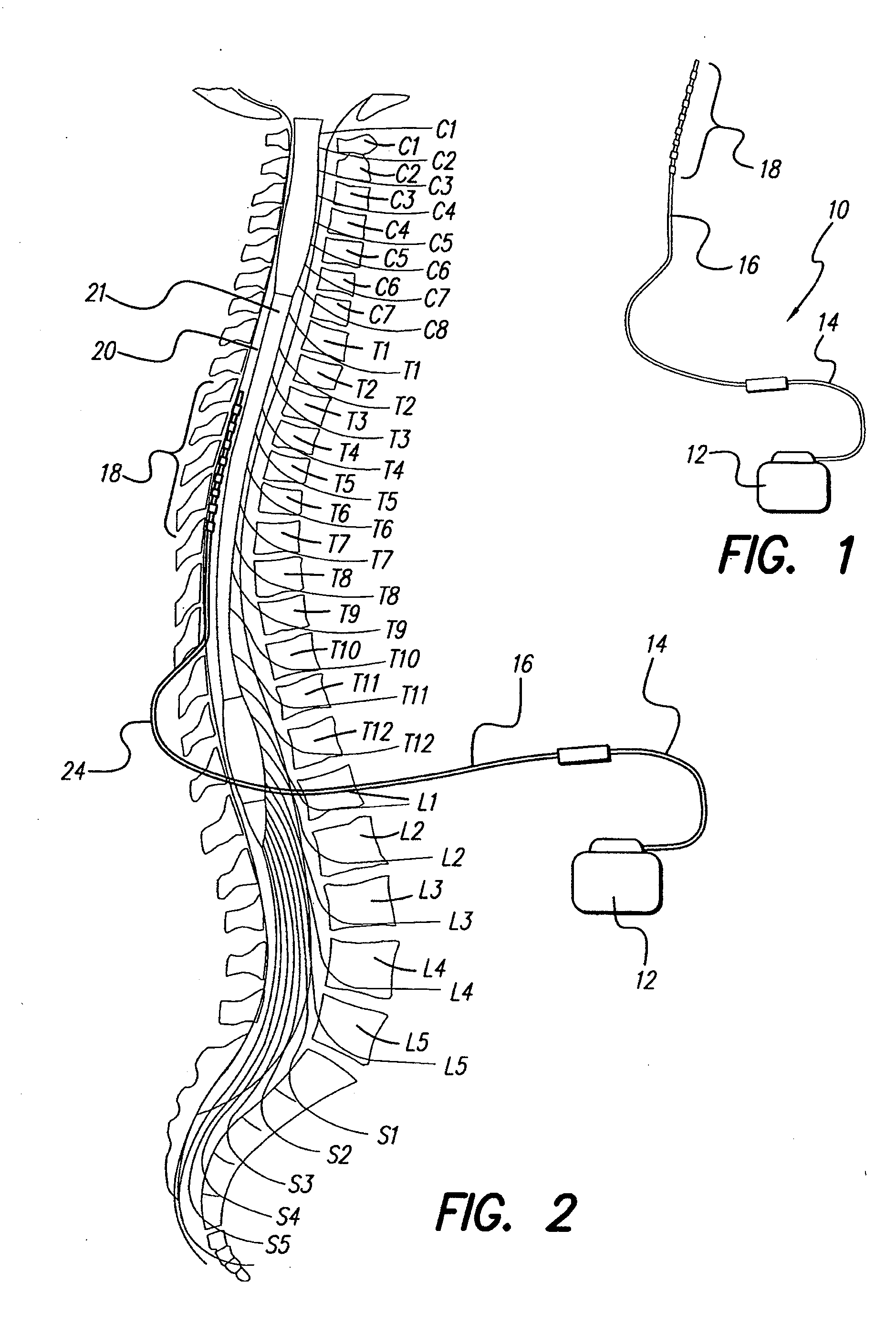 Method for optimizing search for spinal cord stimulation parameter settings