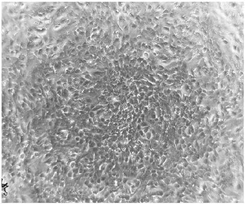 Method for differentiating placenta wall decidual mesenchymal stem cells into endometrial epithelial cells