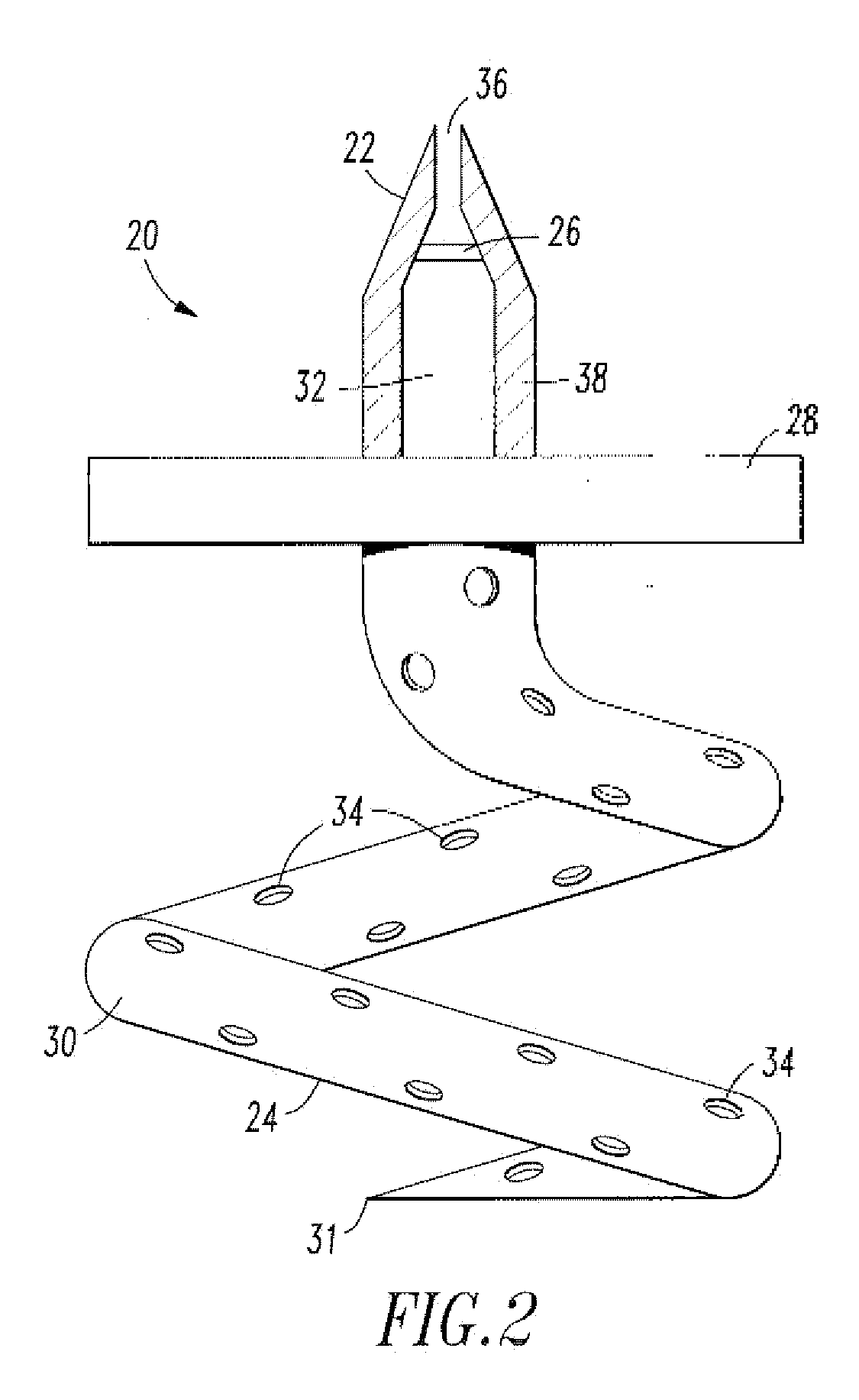 Endovascular cerebrospinal fluid shunt