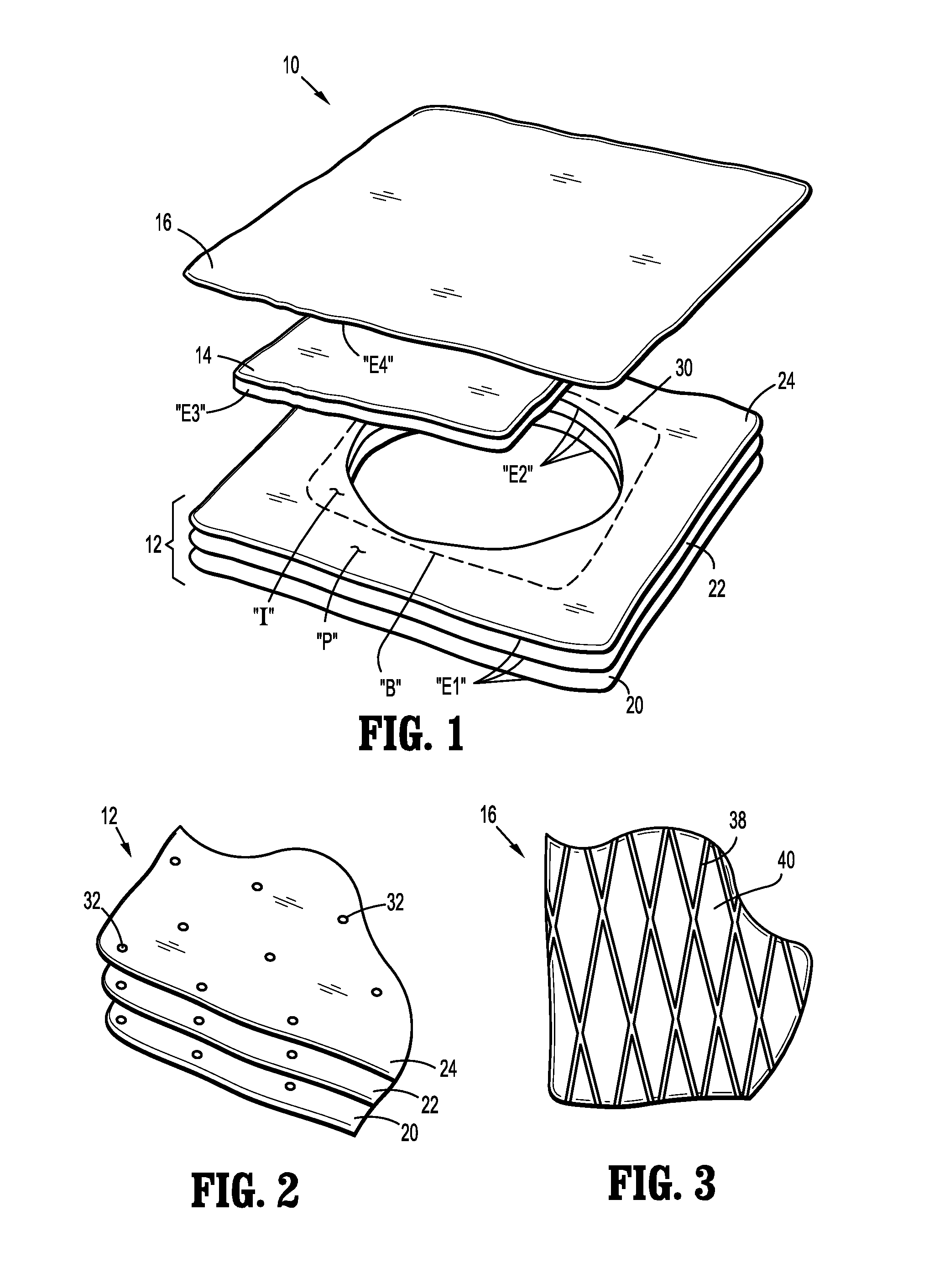 Wound Dressing with Advanced Fluid Handling