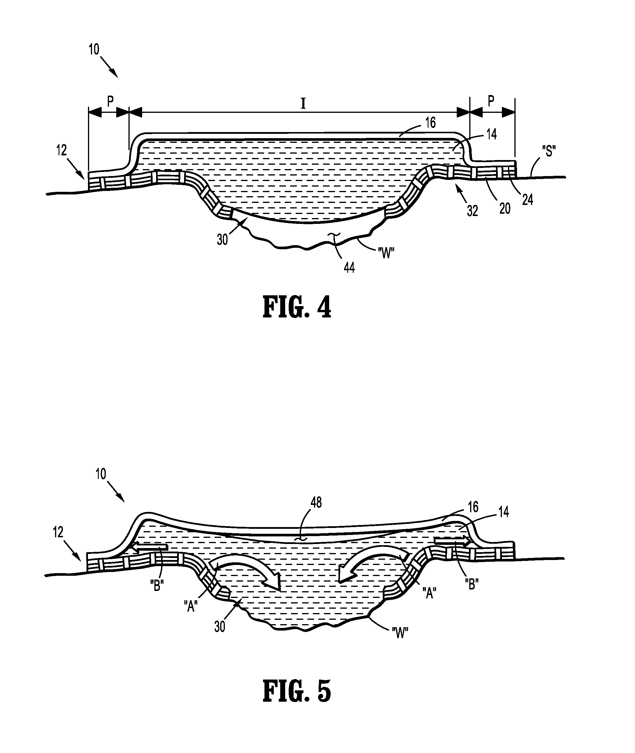 Wound Dressing with Advanced Fluid Handling