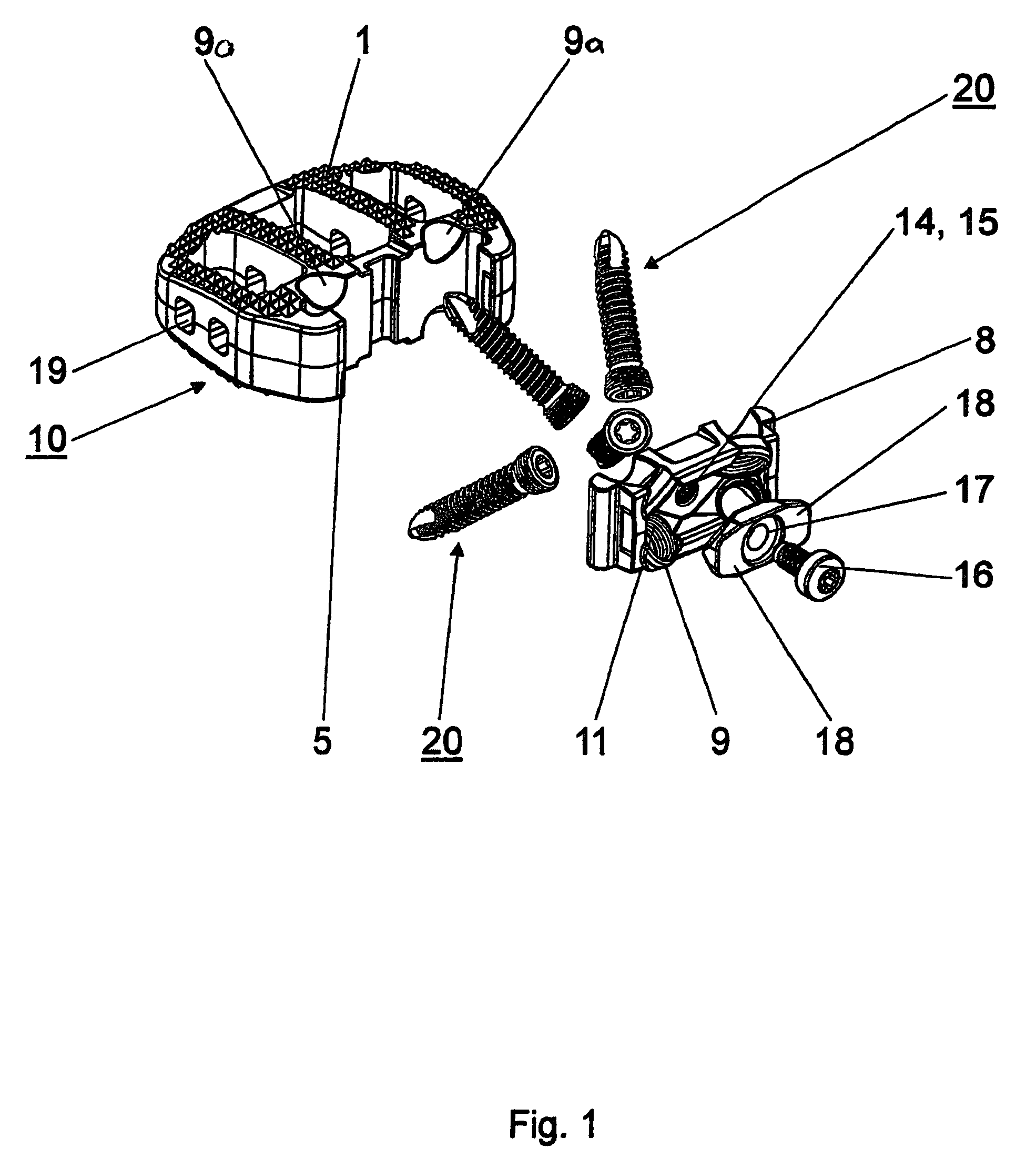 Intervertebral implant