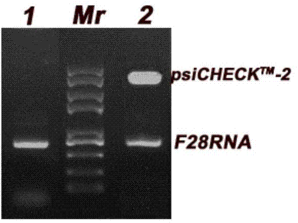 Plasmid for detecting activity of ribosome inactivating protein as well as construction method and application of plasmid