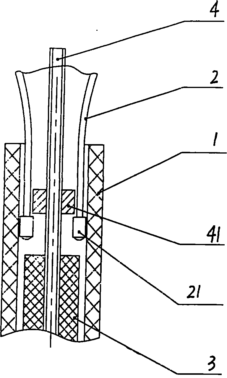 Conveying device for retrievable self-eject nervi cerebrales stent