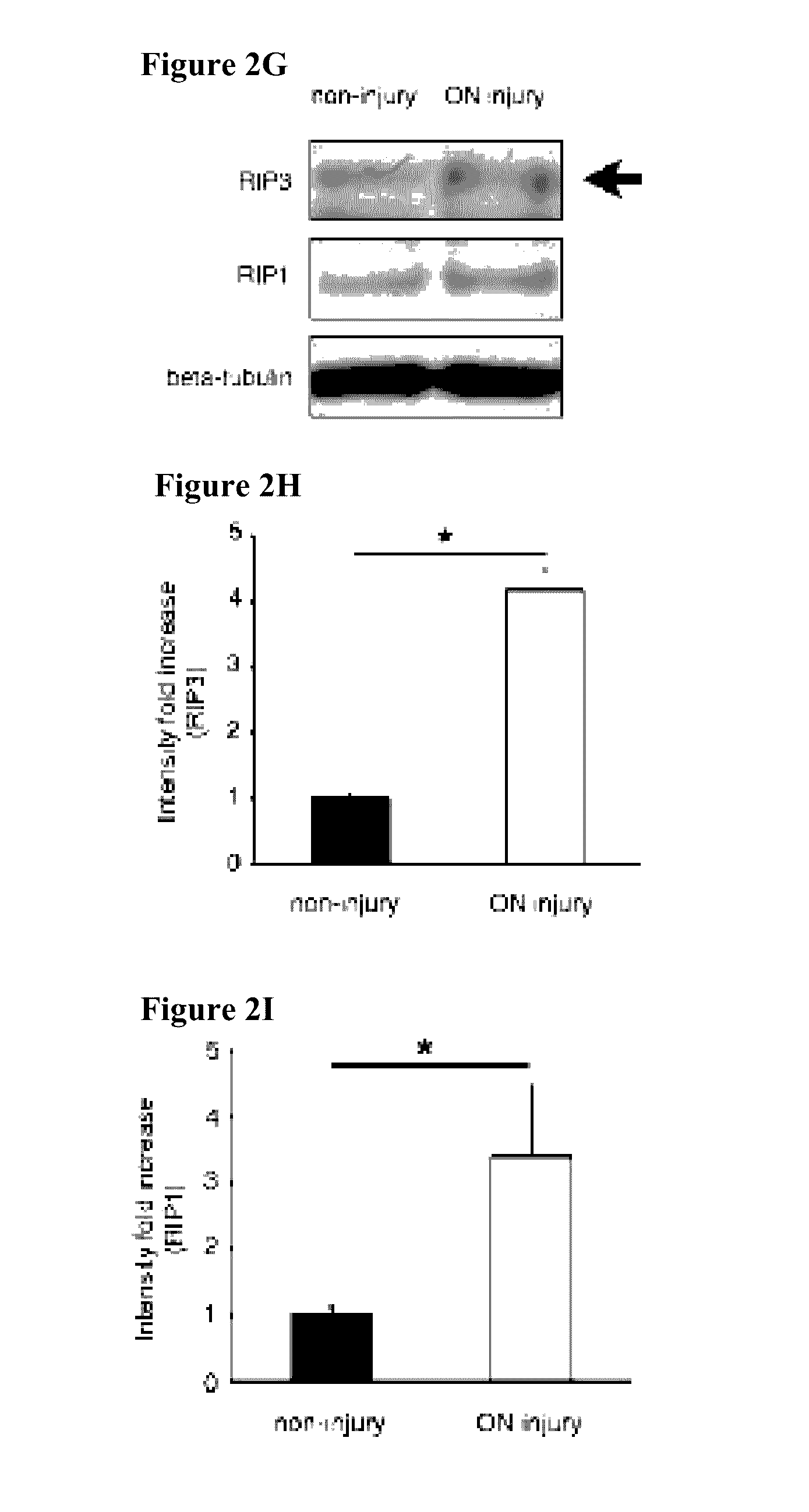 Methods and compositions for preserving retinal ganglion cells