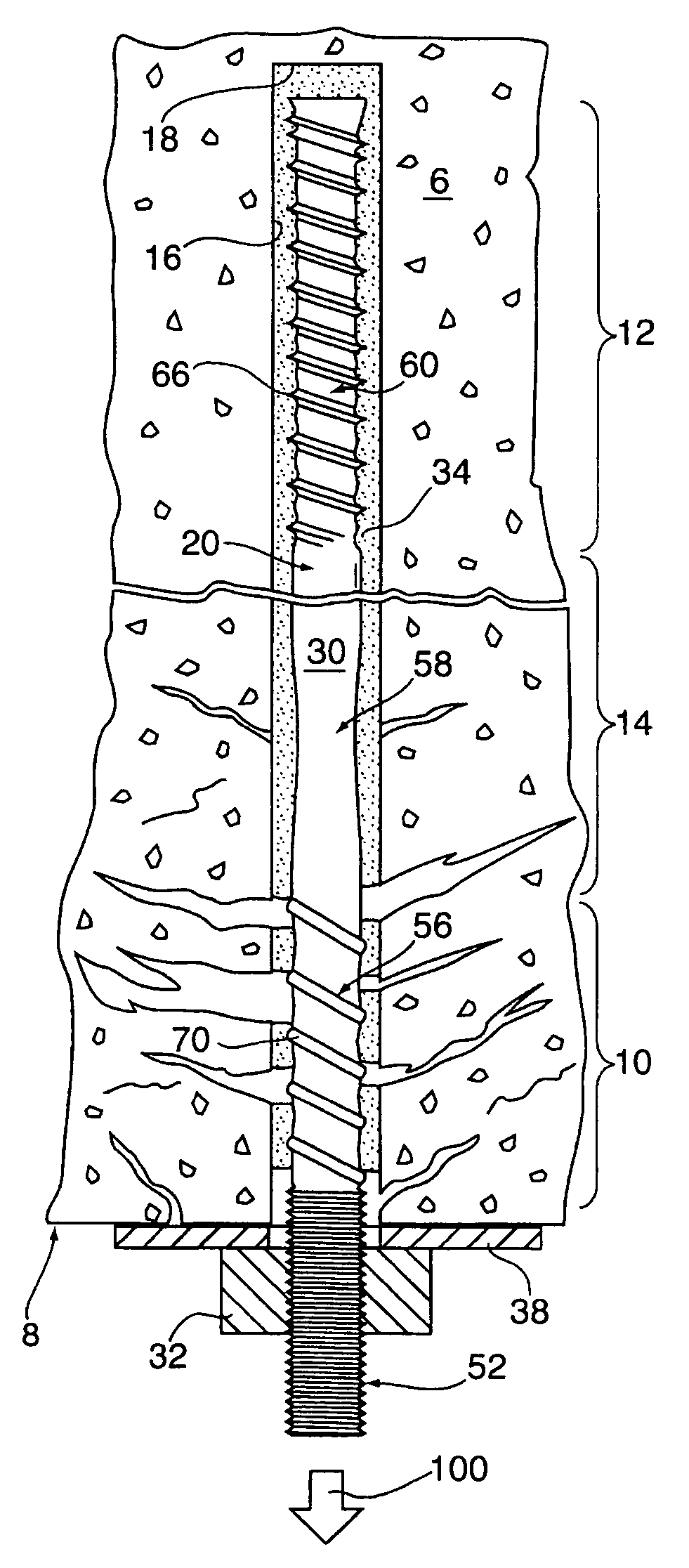 Anchor tendon with selectively deformable portions