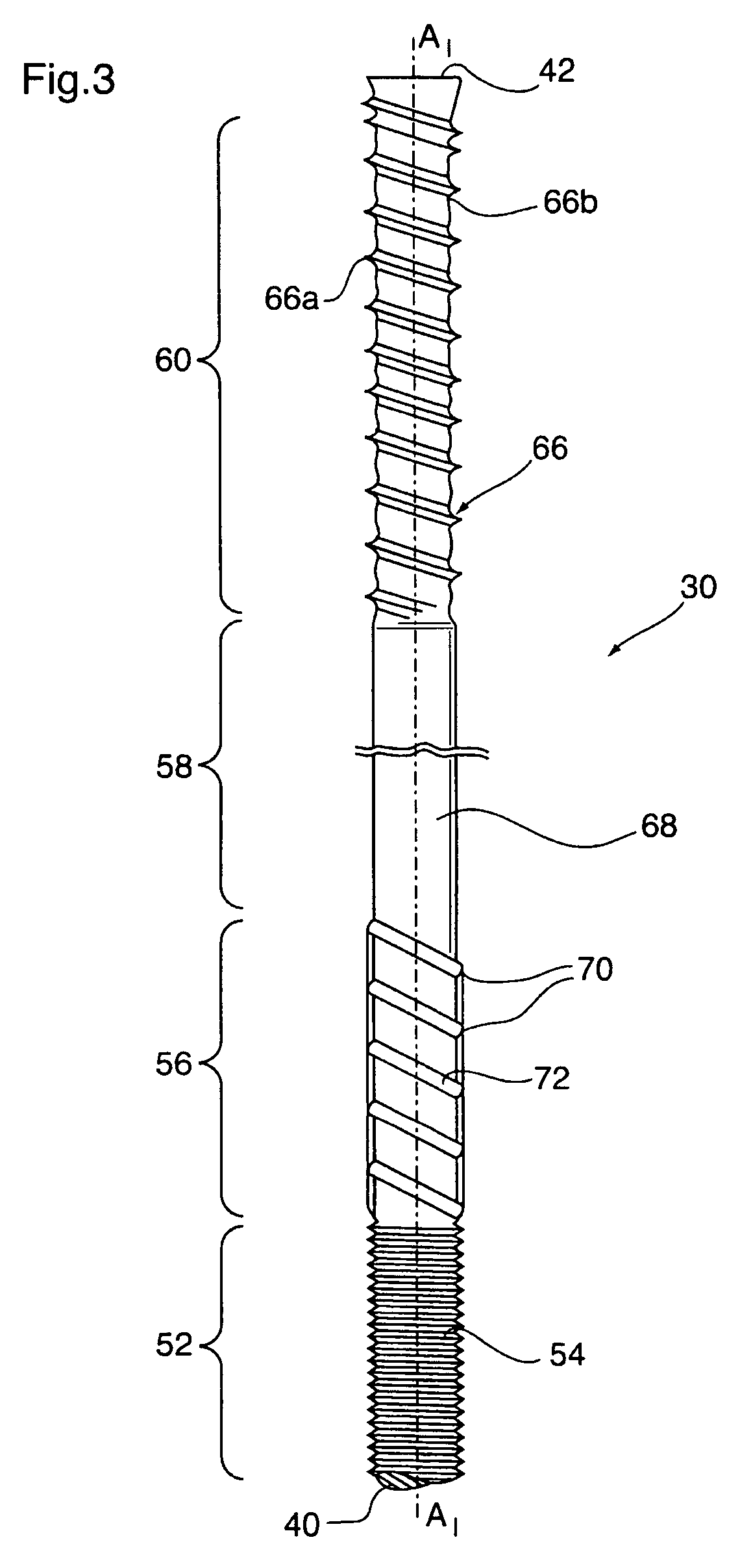 Anchor tendon with selectively deformable portions