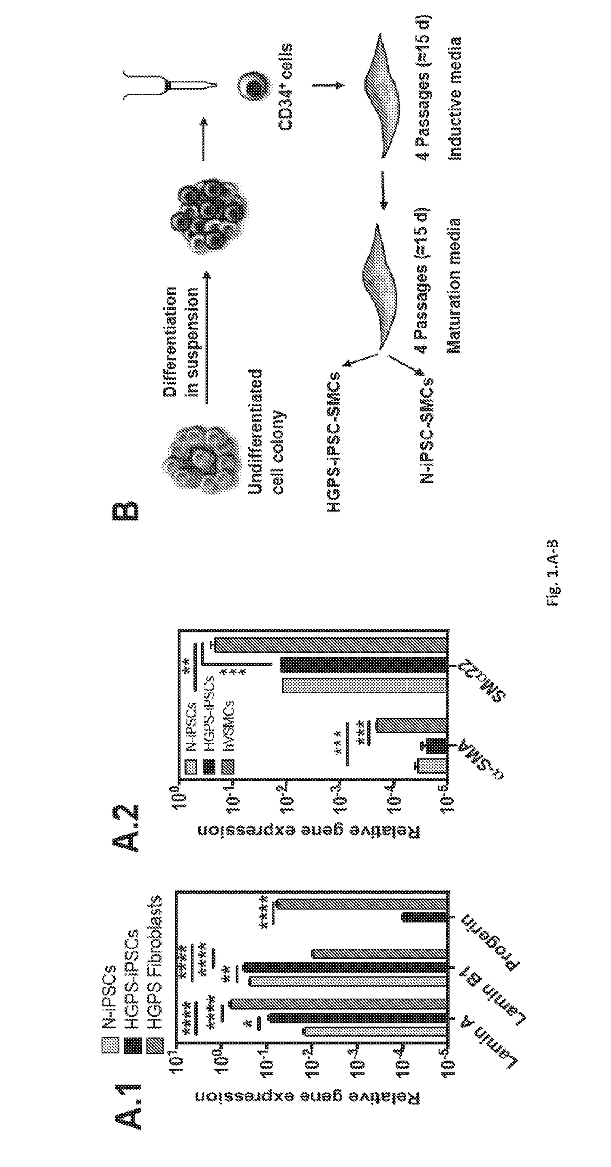 Treatment of hutchinson-gilford progeria syndrome and diseases related to vascular ageing