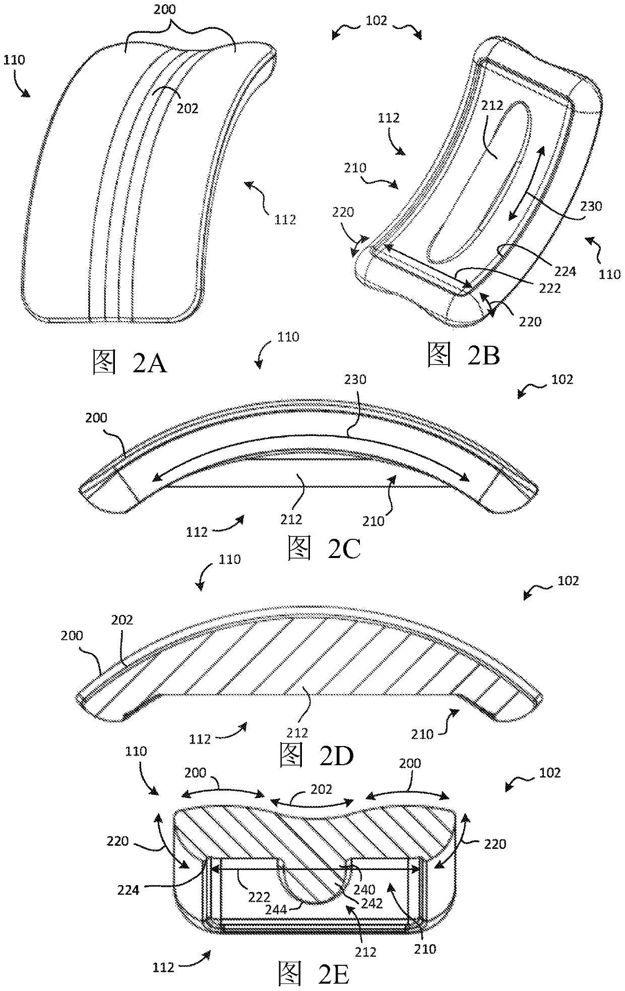 Ankle arthroplasty systems and methods