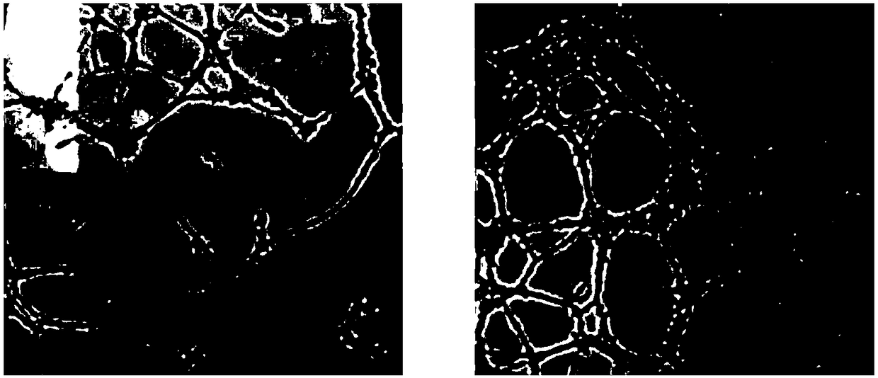 Preparation method of traditional Chinese medicine monomer sequence slow-released calcium-phosphorus support material for osteogenesis and angiogenesis