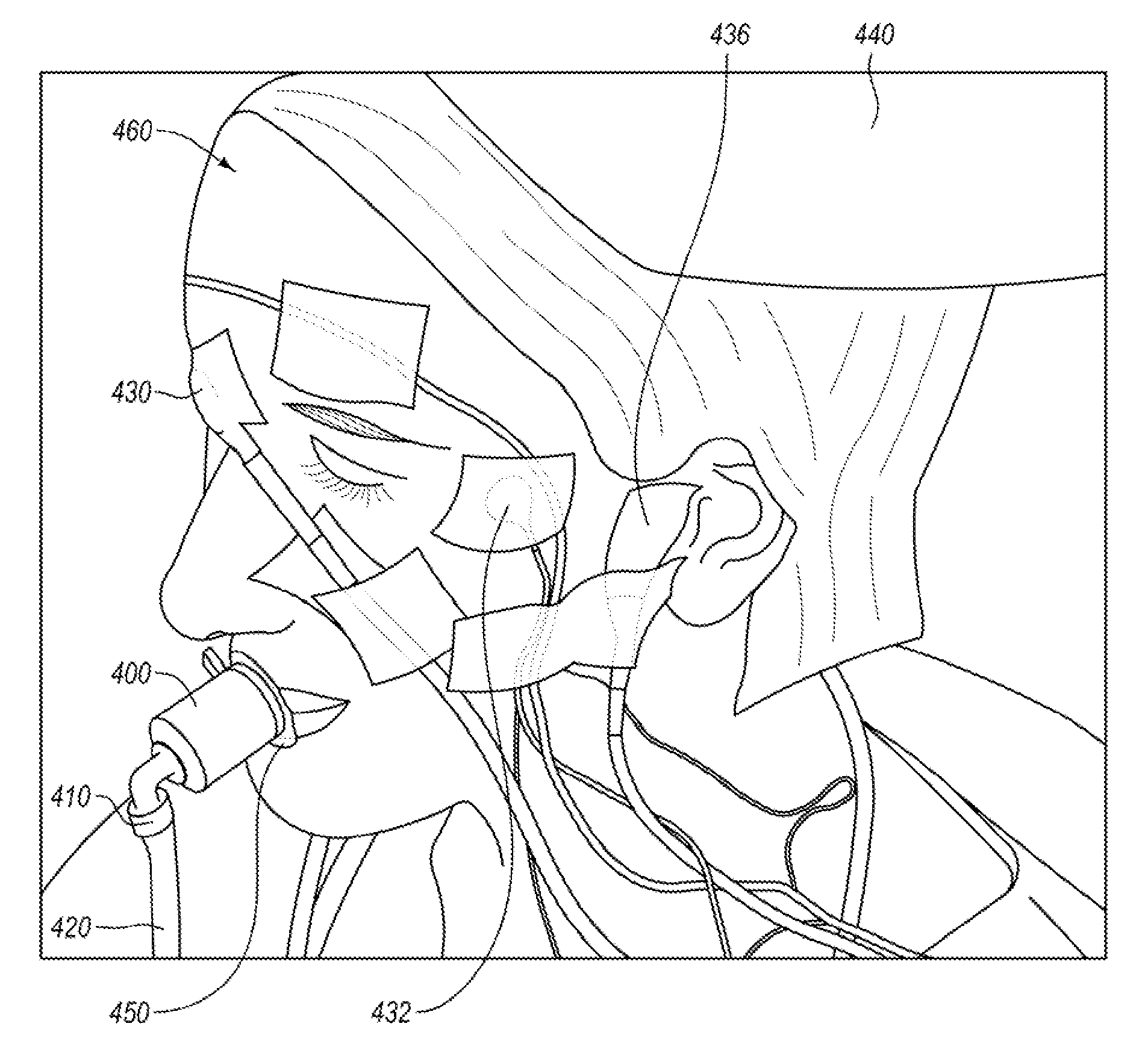 Device, system, and method for mechanosensory nerve ending stimulation