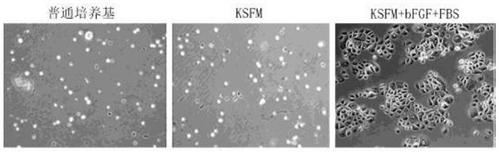 A kind of method for separating and culturing vaginal epithelial cells