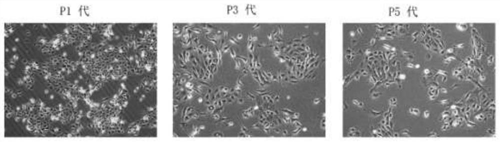 A kind of method for separating and culturing vaginal epithelial cells