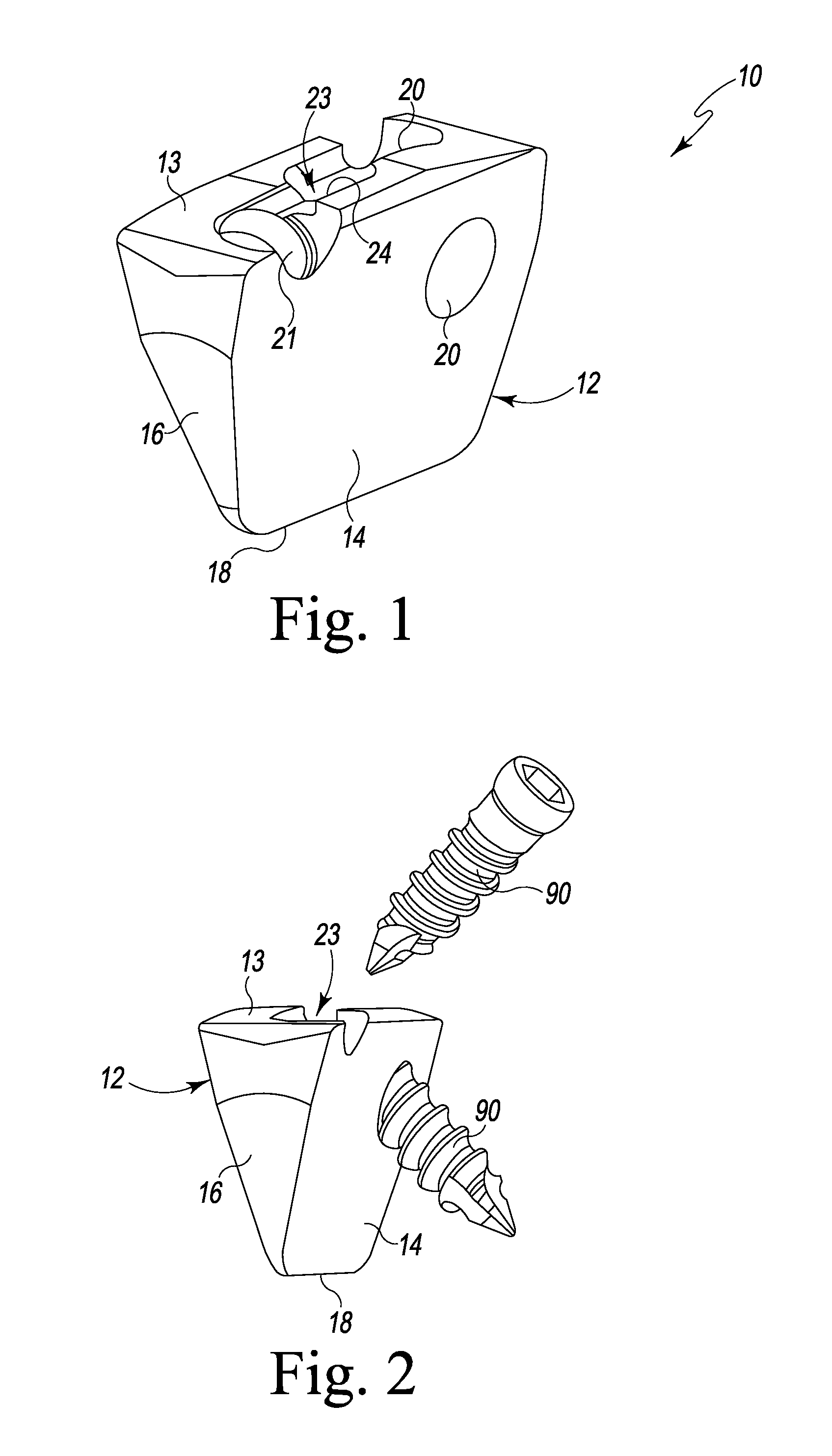 Foot Implant For Bone Fixation