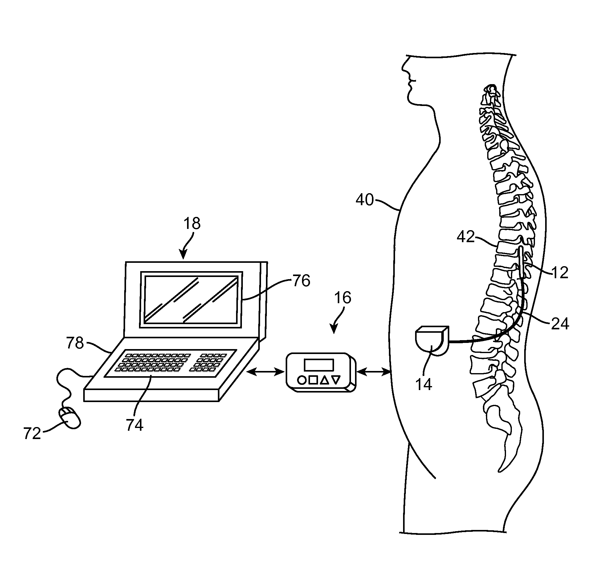 Neurostimulation system and method with graphically manipulatable stimulation target