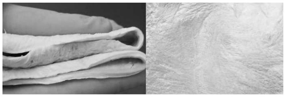 Preparation method of chitosan attapulgite membrane material having function of guiding bone tissue regeneration