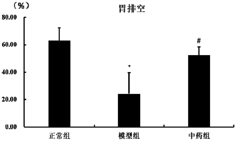 Traditional Chinese medicine compound composition for treating refractory gastroesophageal reflux