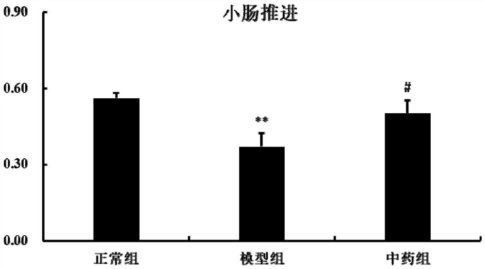 Traditional Chinese medicine compound composition for treating refractory gastroesophageal reflux