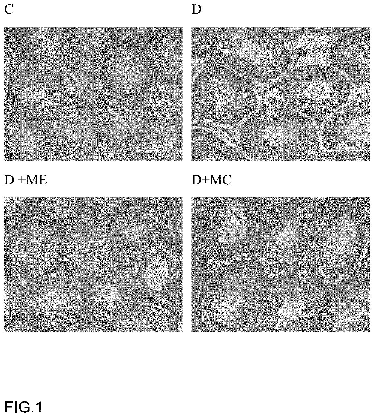 Active substance of <i>Morchella</i>, its use and a composition thereof for improving the reproductive function