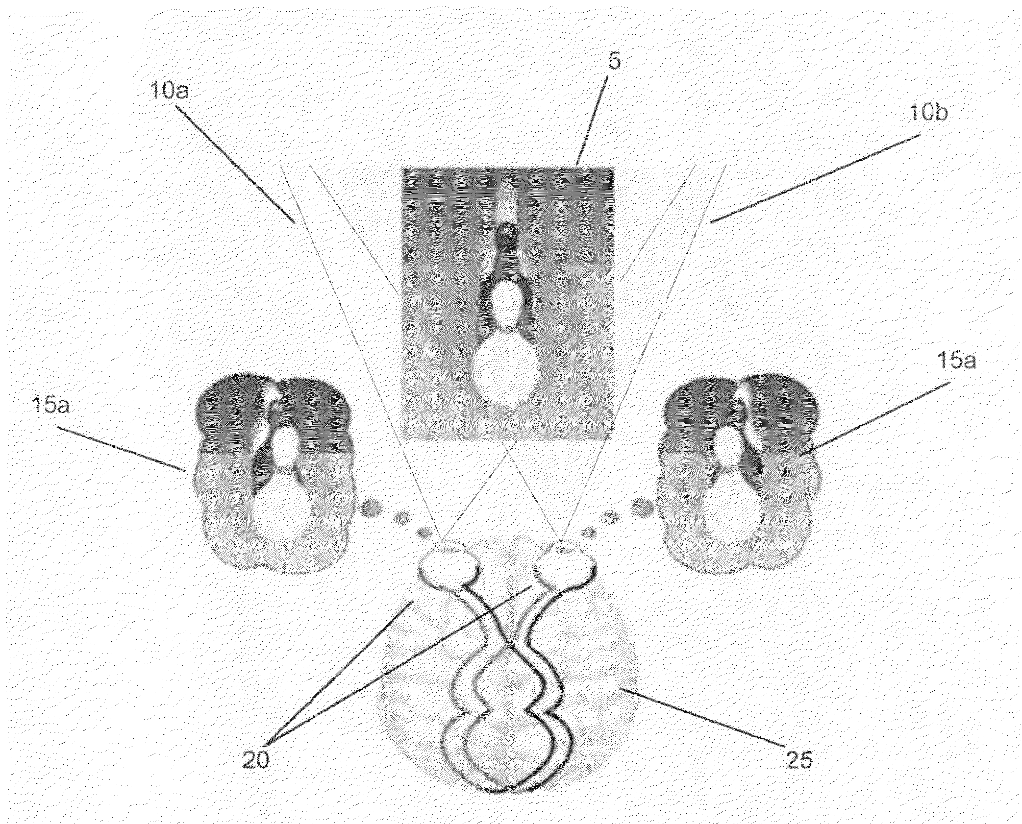 Single camera device and method for 3D video imaging using a refracting lens array