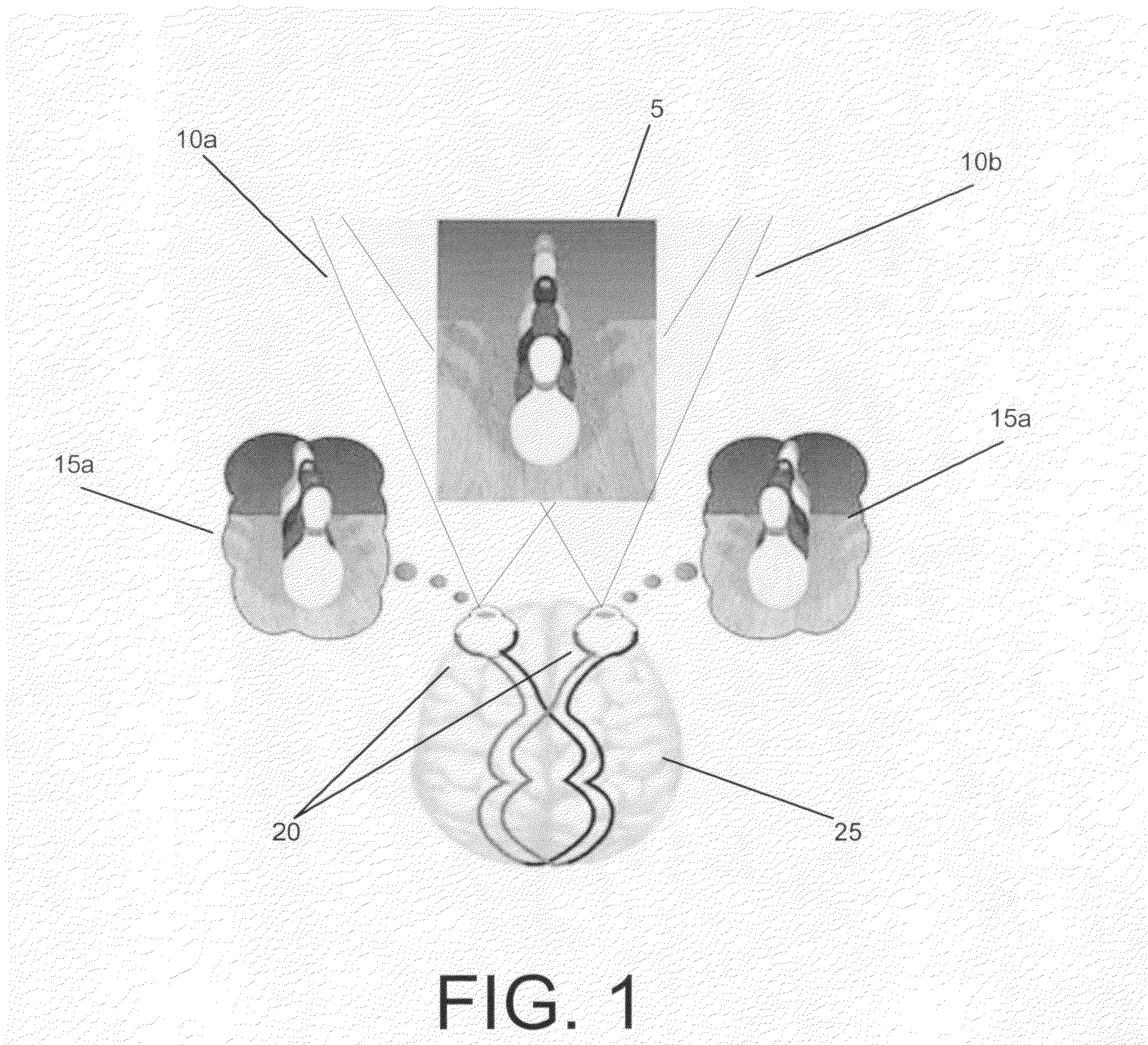 Single camera device and method for 3D video imaging using a refracting lens array