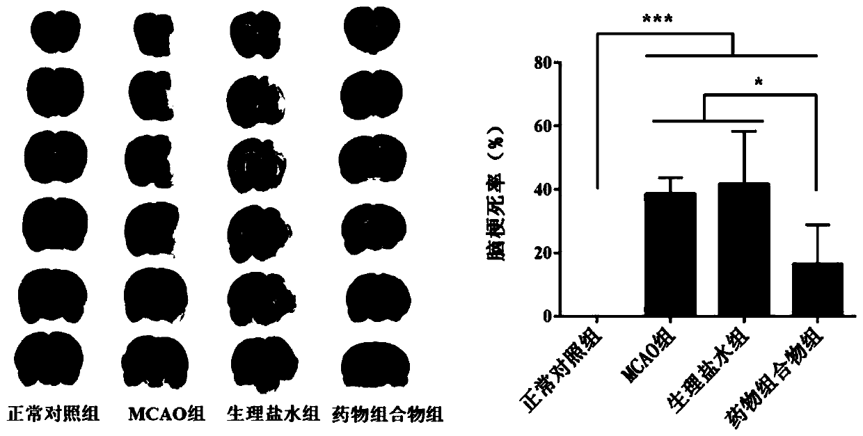 Application of butyric acid compound in preparing drug or functional food for treating ischemic stroke