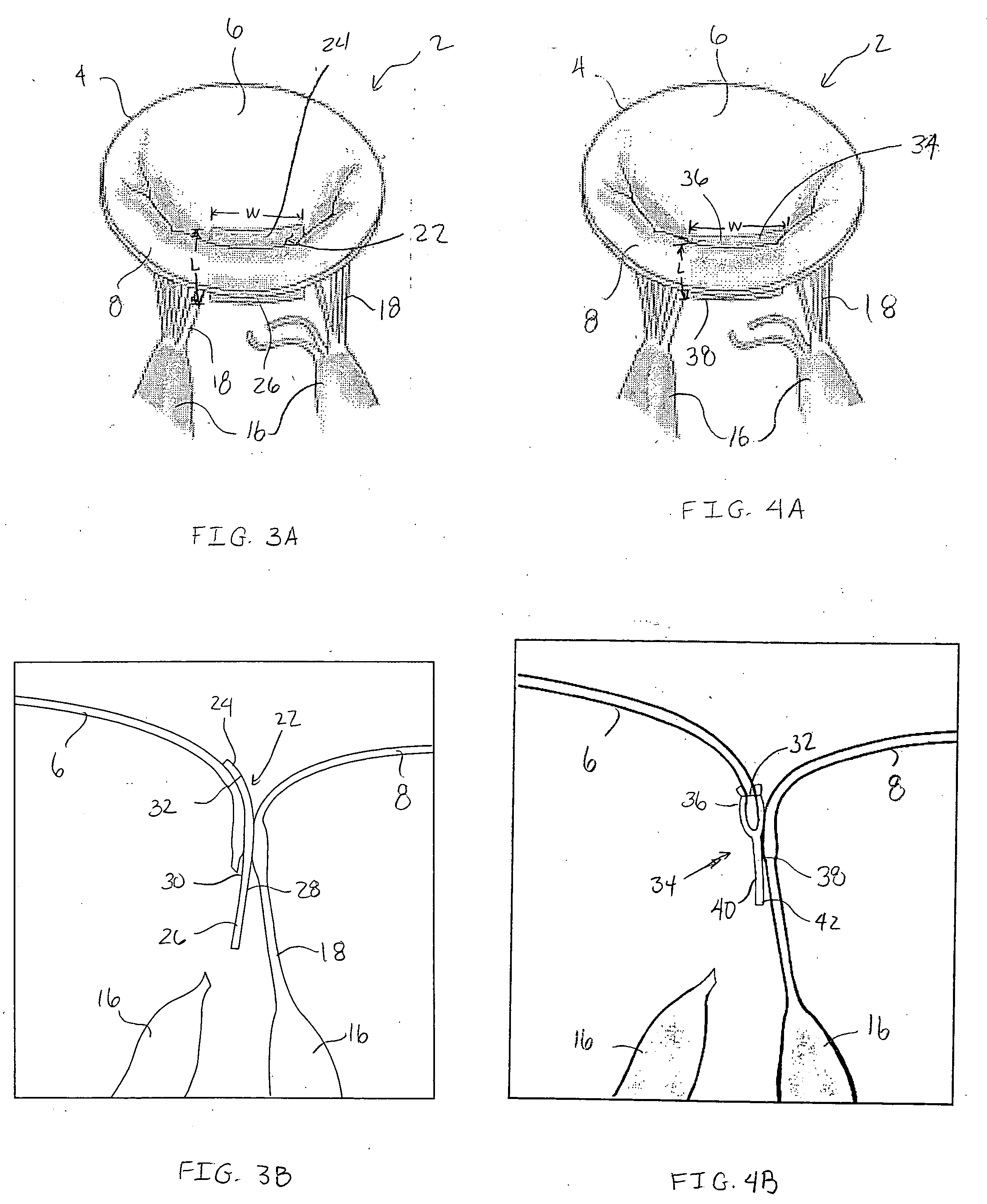 Devices and methods for repairing cardiac valves