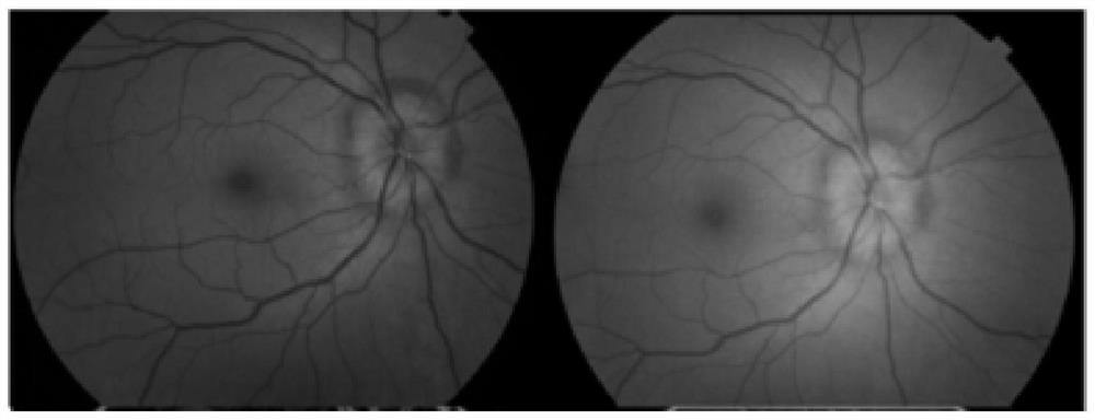 Multi-modal retina image fusion method and system based on image registration